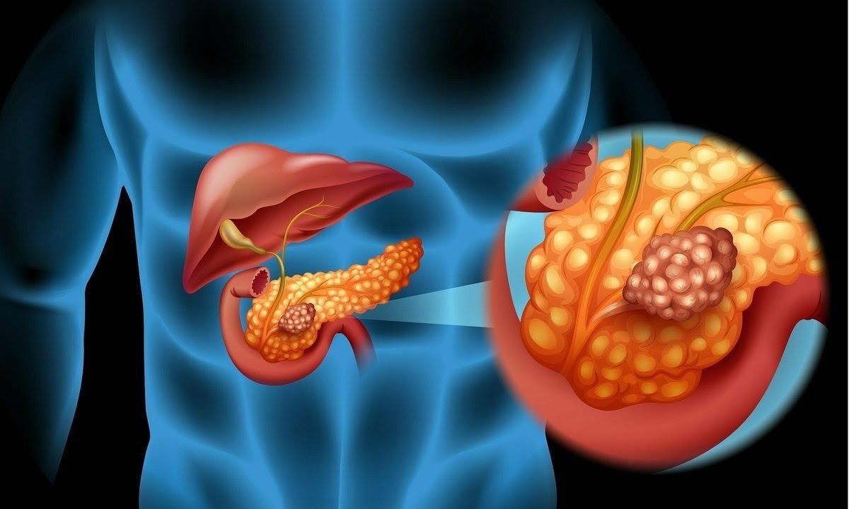 Enzim Không Có Đặc Điểm Nào Sau Đây? Giải Thích Chi Tiết