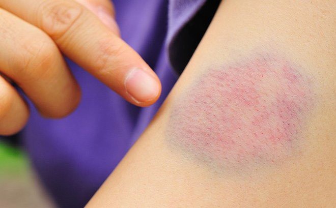 Vòng/Phút Đổi Ra Vòng/Giây: Cách Chuyển Đổi RPM Sang Rad/s &amp; Ứng Dụng