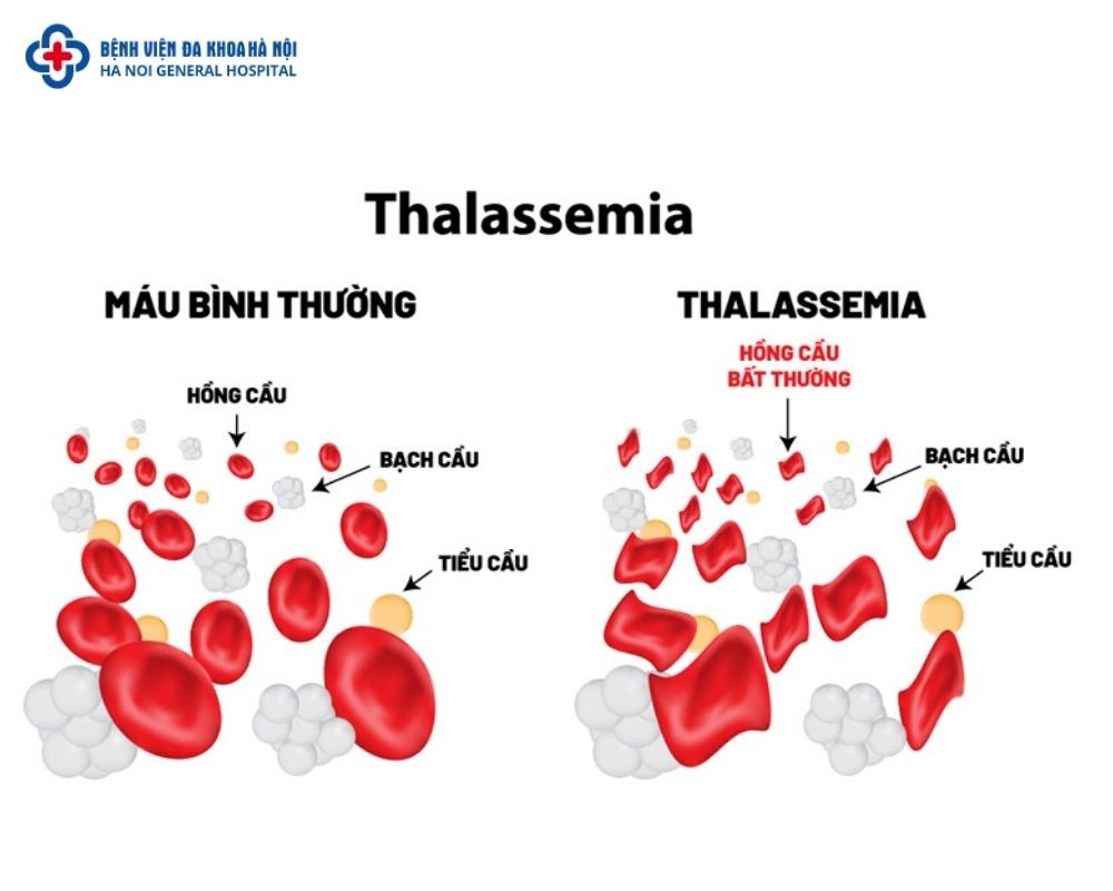 Điều Nào Dưới Đây Không Đúng Về Sự Giống Nhau Giữa Đường Và Lipid?