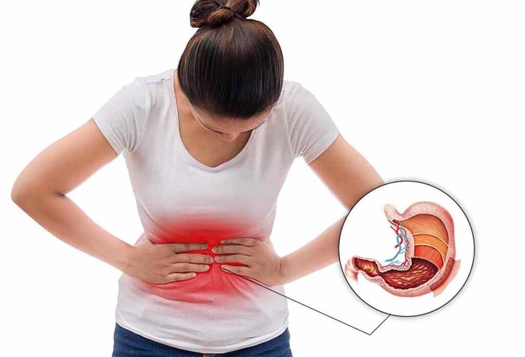 Đau Dạ Dày: Nguyên Nhân Nào Dưới Đây Gây Bệnh Phổ Biến Nhất? Đau Dạ Dày: Nguyên Nhân Nào Dưới Đây Gây Bệnh Phổ Biến Nhất?