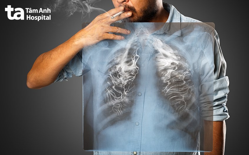 Câu Nói “Bao Giờ Người Tây Nhổ Hết Cỏ Nước Nam” Là Của Ai?