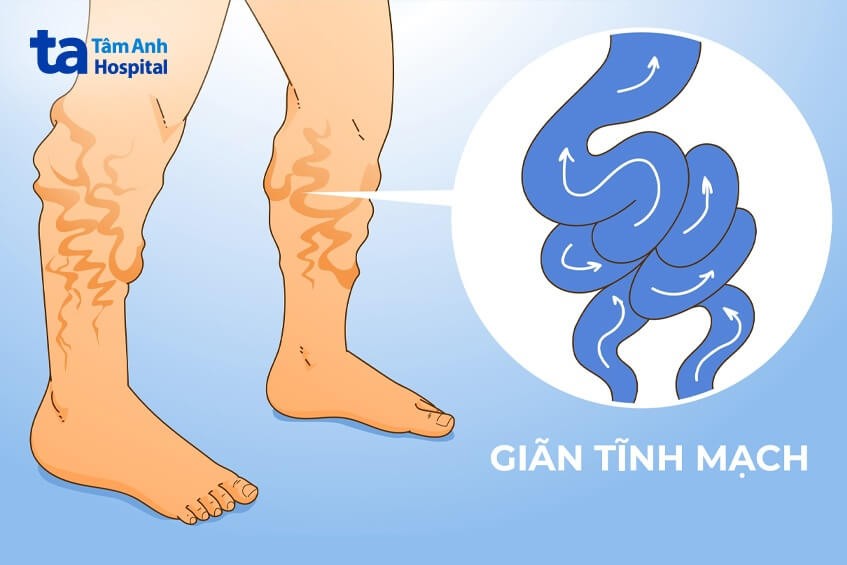 Viết Đoạn Văn Tả Đồ Vật Em Yêu Thích Lớp 3 Hay Nhất? 21+ Mẫu