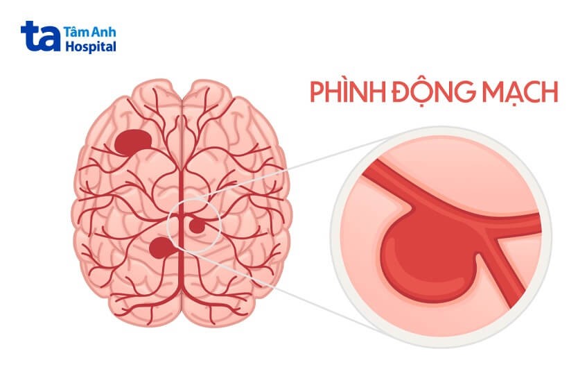 Viết Đoạn Văn Tả Đồ Vật Em Yêu Thích Lớp 3 Hay Nhất? 21+ Mẫu