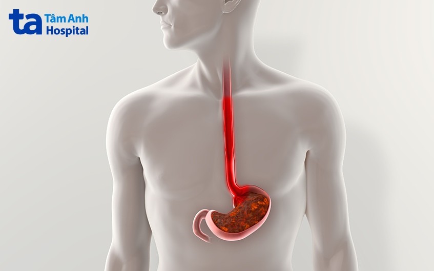 Cấu Tạo Thực Quản: Chức Năng, Bệnh Lý Thường Gặp & Cách Phòng Ngừa Cấu Tạo Thực Quản: Chức Năng, Bệnh Lý Thường Gặp & Cách Phòng Ngừa