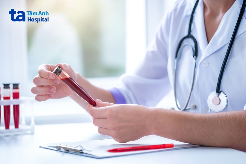 Xét nghiệm máu để biết nhóm máu